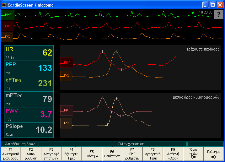 Παράθυρο κυματομορφών του CardioScreen/niccomo