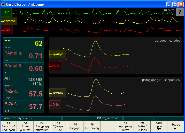 Παράθυρο κυματομορφών του CardioScreen/niccomo