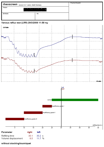 Εκτύπωση αναφοράς αποτελεσμάτων Venous test με rheoscreen light