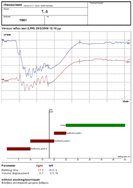 Εκτύπωση αναφοράς αποτελεσμάτων Venous test με rheoscreen light