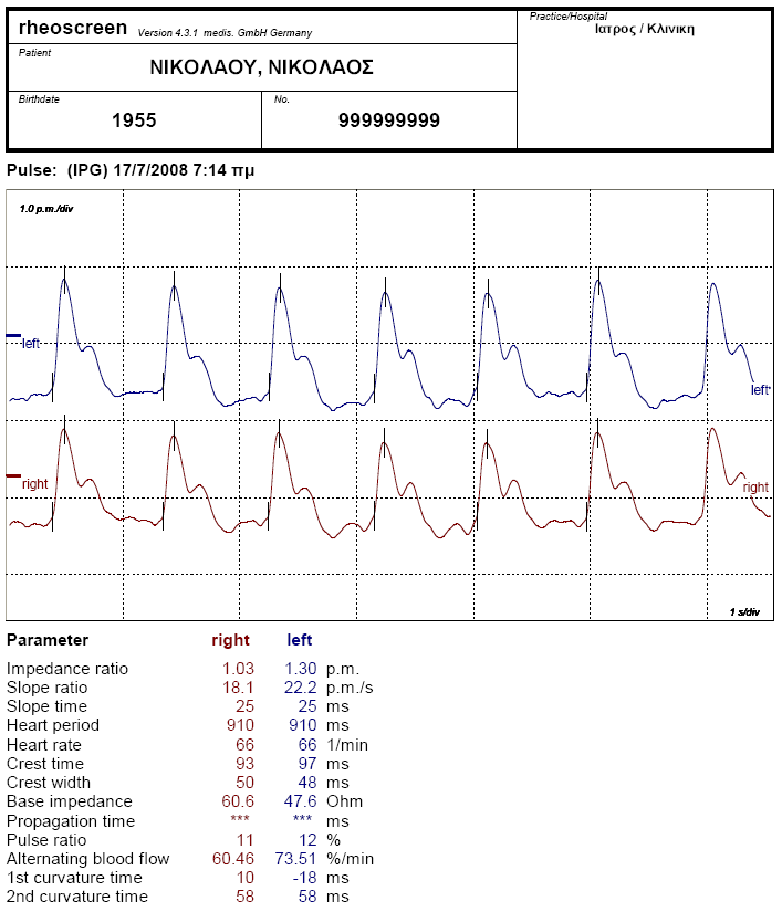 Εκτύπωση αποτελεσμάτων IPG άκρων με rheoscreen compact