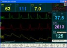 Παράθυρο συνεχούς παρακολούθησης του CardioScreen/niccomo