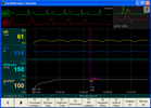 Παράθυρο των τάσεων του CardioScreen/niccomo